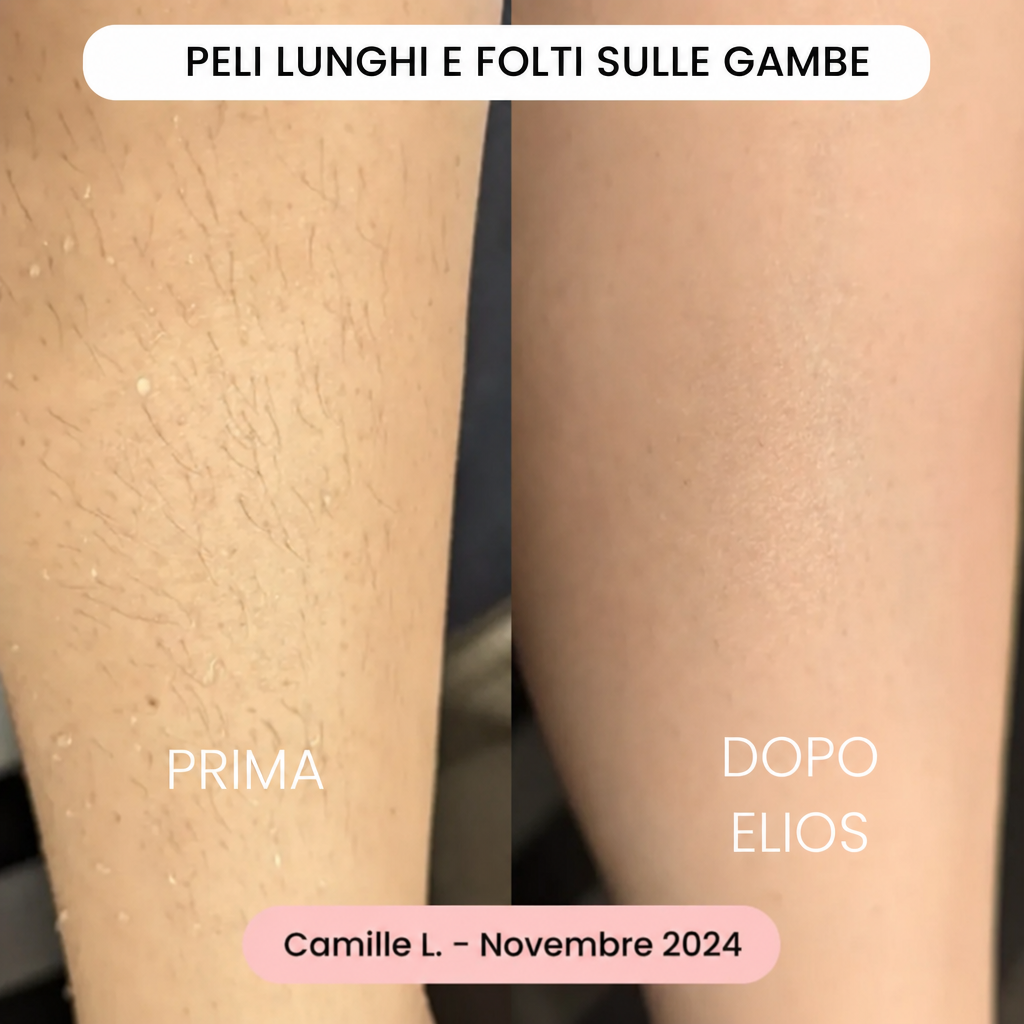 Rasoio Nyveli®