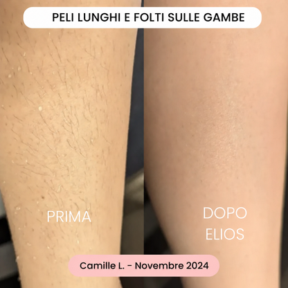 Rasoio Nyveli®